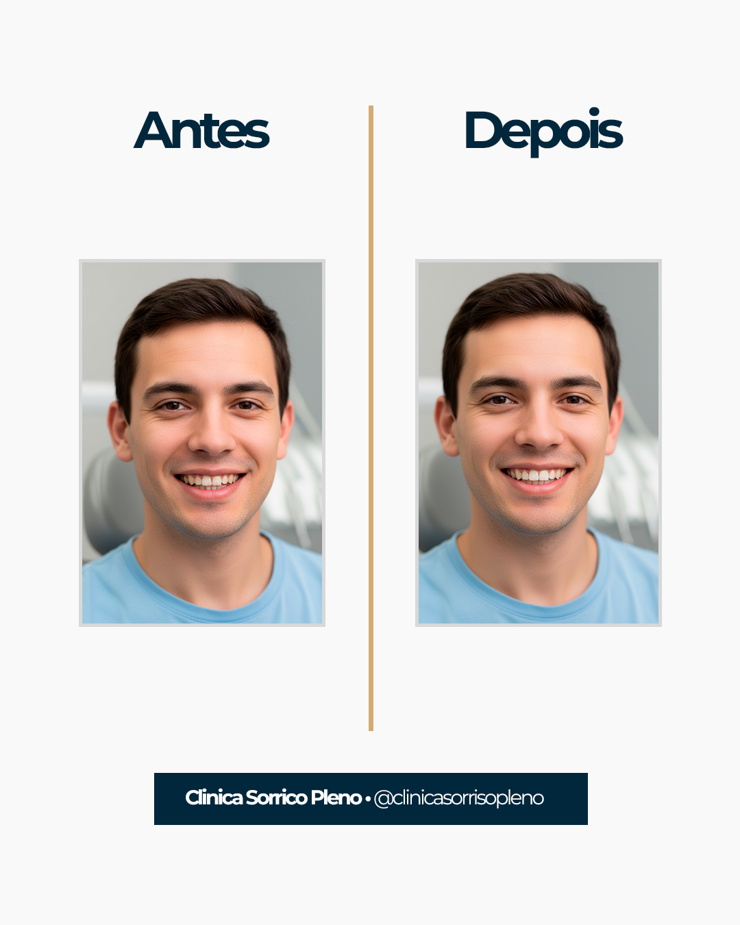 Prévia de template em 4:5